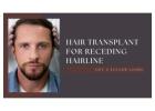 Hair Transplant for Receding Hairline – Get a Fuller Look!